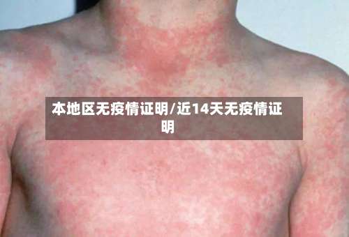 本地区无疫情证明/近14天无疫情证明-第1张图片